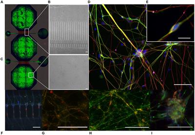 Micro-and mesoscale aspects of neurodegeneration in engineered human neural networks carrying the LRRK2 G2019S mutation
